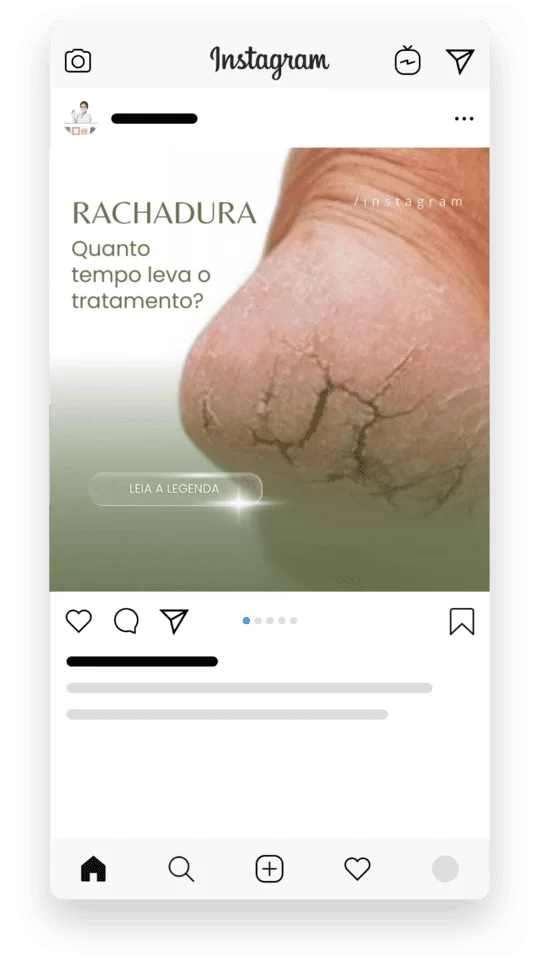 Melhor Pack Podologia Instagram