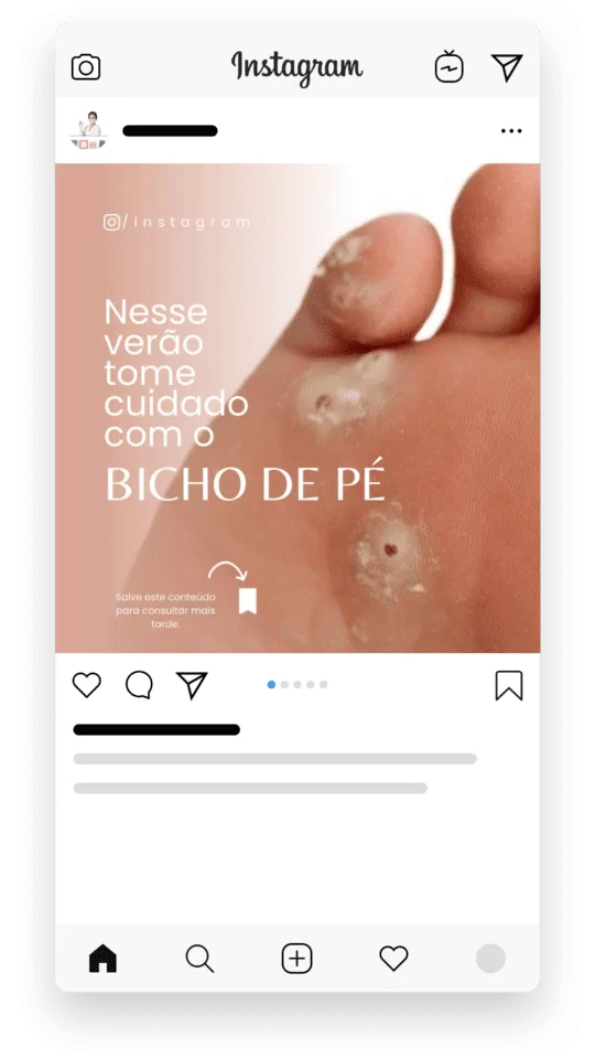 Melhor Pack Podologia Instagram