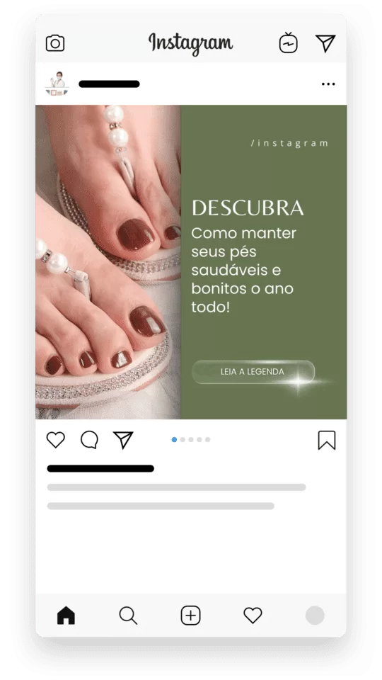 Melhor Pack Podologia Instagram