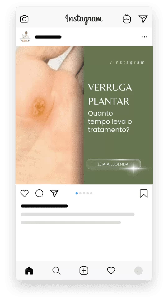 Melhor Pack Podologia Instagram